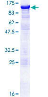 12.5% SDS-PAGE Stained with Coomassie Blue.