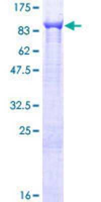 12.5% SDS-PAGE Stained with Coomassie Blue.