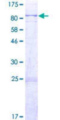 12.5% SDS-PAGE Stained with Coomassie Blue.
