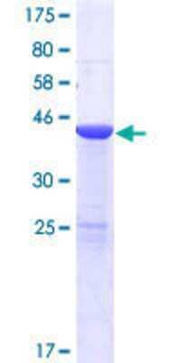 Other Recombinant Human USP47 GST (N-Term) Protein
