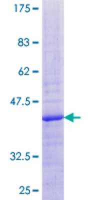 12.5% SDS-PAGE Stained with Coomassie Blue.