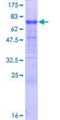 12.5% SDS-PAGE Stained with Coomassie Blue.