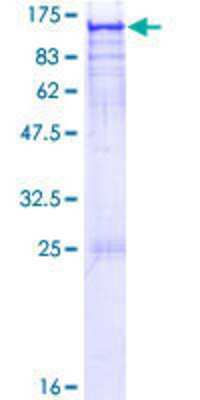 Other Recombinant Human ARHGAP17 GST (N-Term) Protein