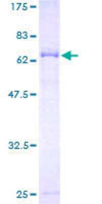 12.5% SDS-PAGE Stained with Coomassie Blue.