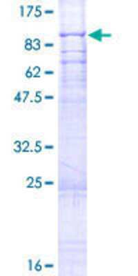 12.5% SDS-PAGE Stained with Coomassie Blue.