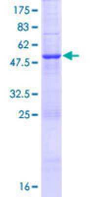 12.5% SDS-PAGE Stained with Coomassie Blue.