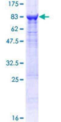 12.5% SDS-PAGE Stained with Coomassie Blue.