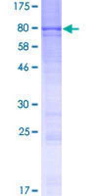 12.5% SDS-PAGE Stained with Coomassie Blue.