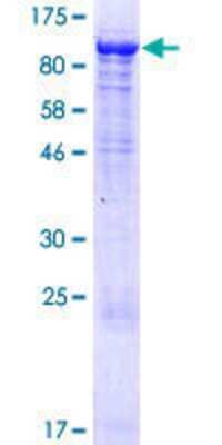 12.5% SDS-PAGE Stained with Coomassie Blue.