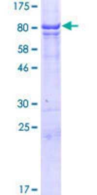 12.5% SDS-PAGE Stained with Coomassie Blue.