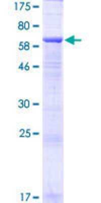 12.5% SDS-PAGE Stained with Coomassie Blue.