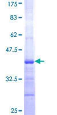 Other Recombinant Human NAD Synthetase GST (N-Term) Protein