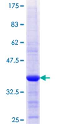 12.5% SDS-PAGE Stained with Coomassie Blue.