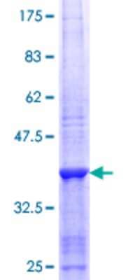 12.5% SDS-PAGE Stained with Coomassie Blue.