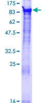 12.5% SDS-PAGE Stained with Coomassie Blue.