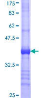 12.5% SDS-PAGE Stained with Coomassie Blue.