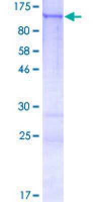 12.5% SDS-PAGE Stained with Coomassie Blue.