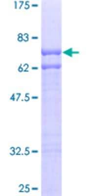 12.5% SDS-PAGE Stained with Coomassie Blue.