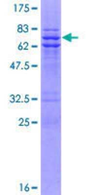 12.5% SDS-PAGE Stained with Coomassie Blue.