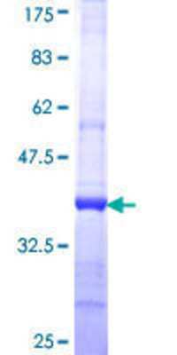 12.5% SDS-PAGE Stained with Coomassie Blue.