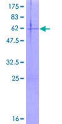 12.5% SDS-PAGE Stained with Coomassie Blue.