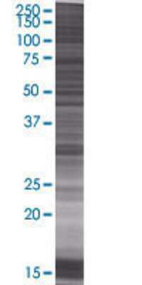 ECHDC2 transfected lysate.
