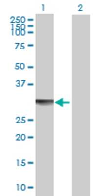 Lane 1: ECHDC2 transfected lysate (32.23 KDa) Lane 2: Non-transfected lysate.