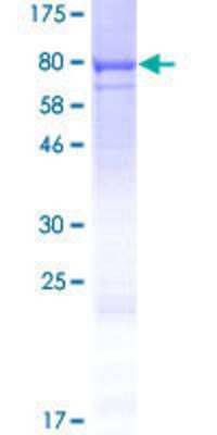 12.5% SDS-PAGE Stained with Coomassie Blue.