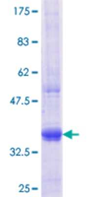 12.5% SDS-PAGE Stained with Coomassie Blue.