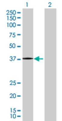Lane 1: ZNF444 transfected lysate (35.97 KDa) Lane 2: Non-transfected lysate.