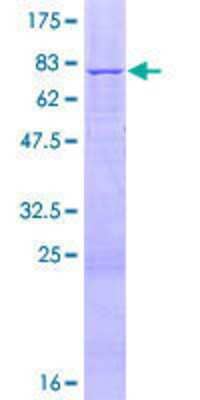 12.5% SDS-PAGE Stained with Coomassie Blue.