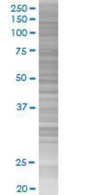 C14orf106 transfected lysate.