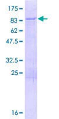 12.5% SDS-PAGE Stained with Coomassie Blue.