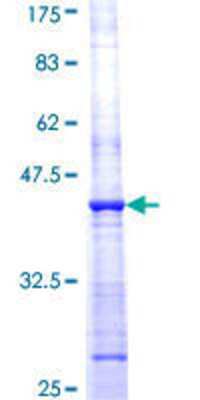12.5% SDS-PAGE Stained with Coomassie Blue.