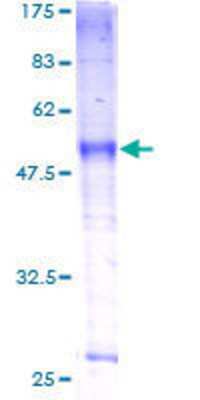 12.5% SDS-PAGE Stained with Coomassie Blue.