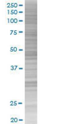 ZNF331 transfected lysate.