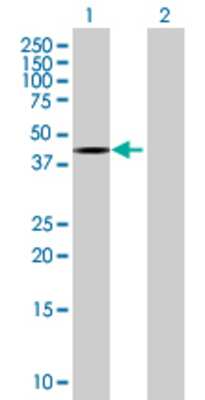 Lane 1: ZNF331 transfected lysate (51.04 KDa) Lane 2: Non-transfected lysate.