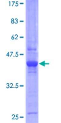 12.5% SDS-PAGE Stained with Coomassie Blue.