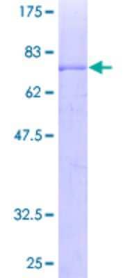 12.5% SDS-PAGE Stained with Coomassie Blue.