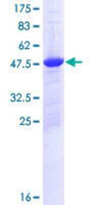 12.5% SDS-PAGE Stained with Coomassie Blue.