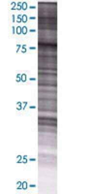 SMPD3 transfected lysate.