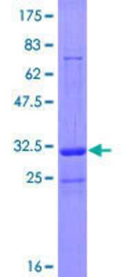 12.5% SDS-PAGE Stained with Coomassie Blue.