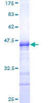 12.5% SDS-PAGE Stained with Coomassie Blue.