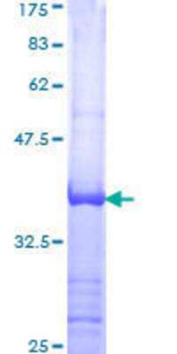 12.5% SDS-PAGE Stained with Coomassie Blue.
