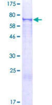 12.5% SDS-PAGE Stained with Coomassie Blue.