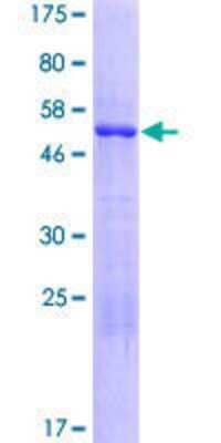 12.5% SDS-PAGE Stained with Coomassie Blue.
