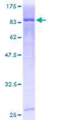 Unknown Recombinant Human CARF/CDKN2AIP GST (N-Term) Protein