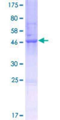 12.5% SDS-PAGE Stained with Coomassie Blue.