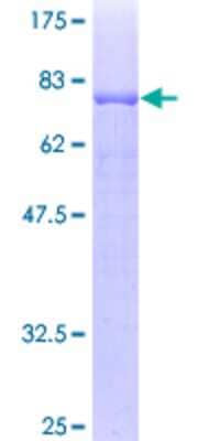 12.5% SDS-PAGE Stained with Coomassie Blue.