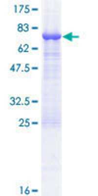 12.5% SDS-PAGE Stained with Coomassie Blue.